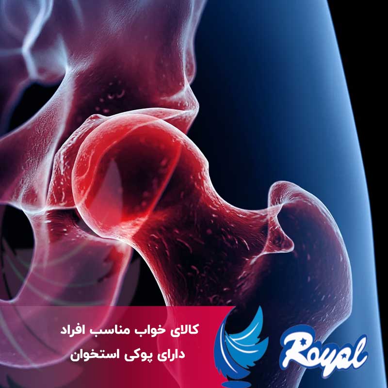 کالای خواب مناسب افراد دارای پوکی استخوان