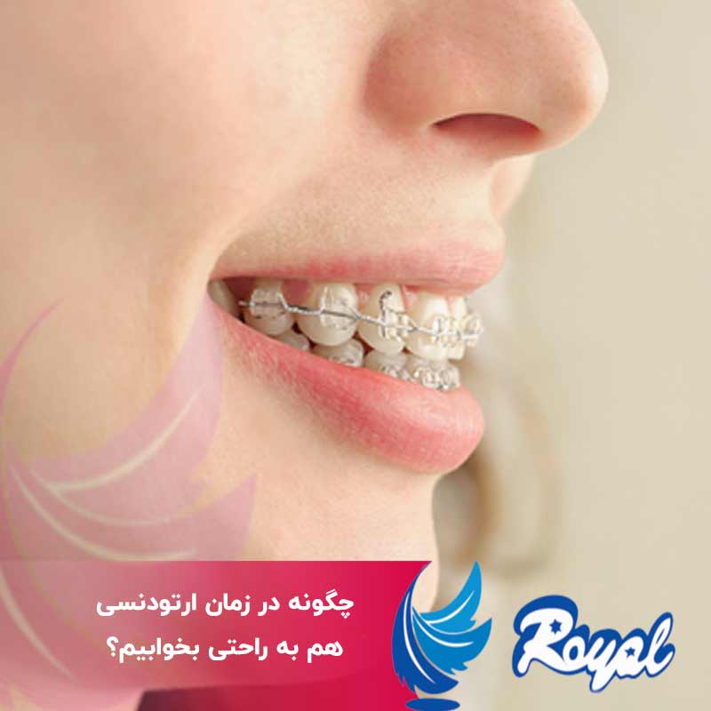 چگونه در زمان ارتودنسی هم به راحتی بخوابیم