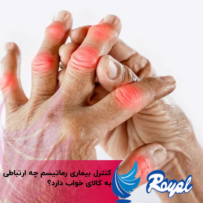 کنترل بیماری رماتیسم