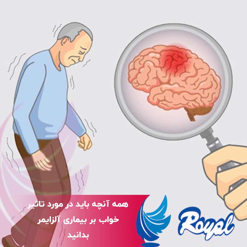 تاثیر خواب بر بیماری آلزایمر