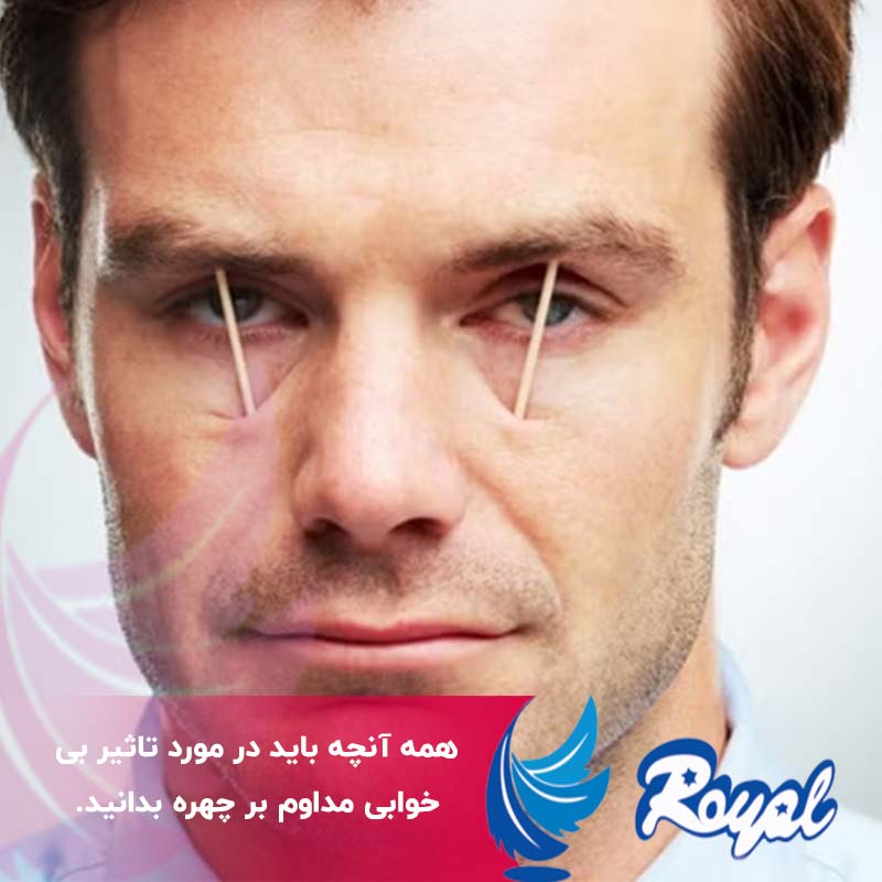 تاثیر بی خوابی مداوم بر چهره